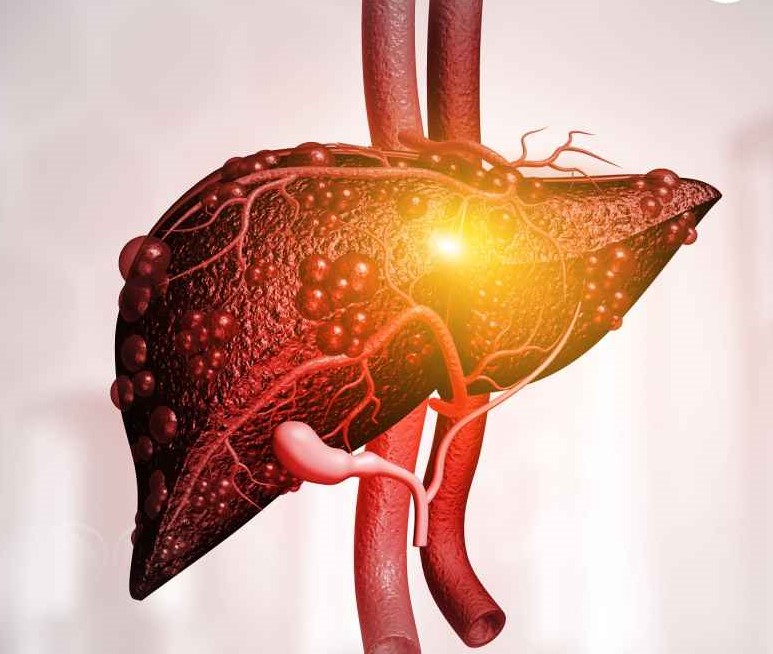 stem cells treatment for liver disorders
