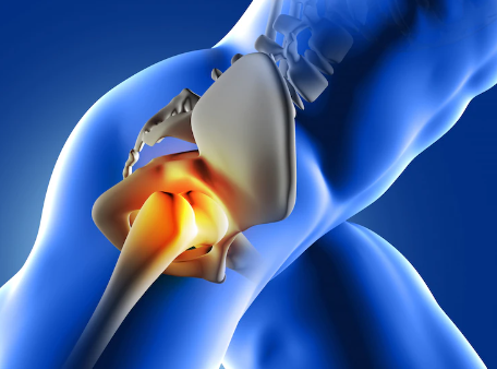 Revolutionary Stem Cell Therapy For Hip Joint